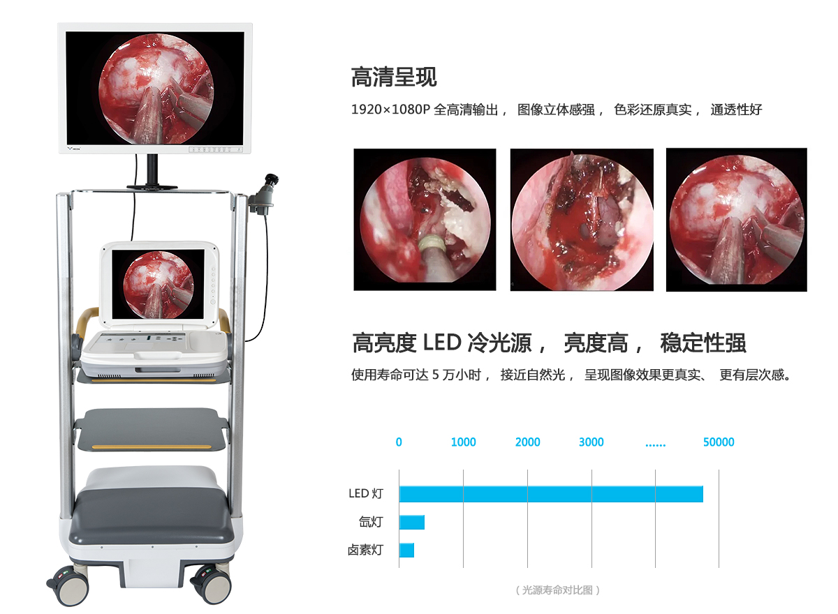 普通白光联合窄带成像放大内镜对早期胃癌浸润深度的诊断价值